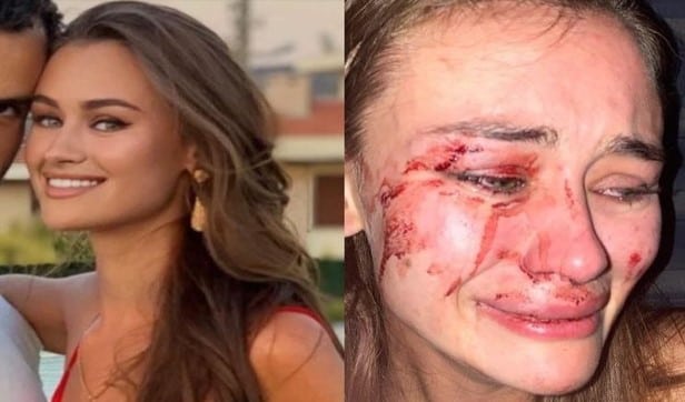 Saldırıya Bakan Ersoy'dan da tepki: Kimsenin yanına kâr kalmayacak!