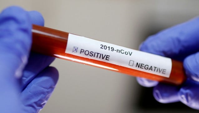 Türkiye'den dönen turistte koronavirüs çıktı