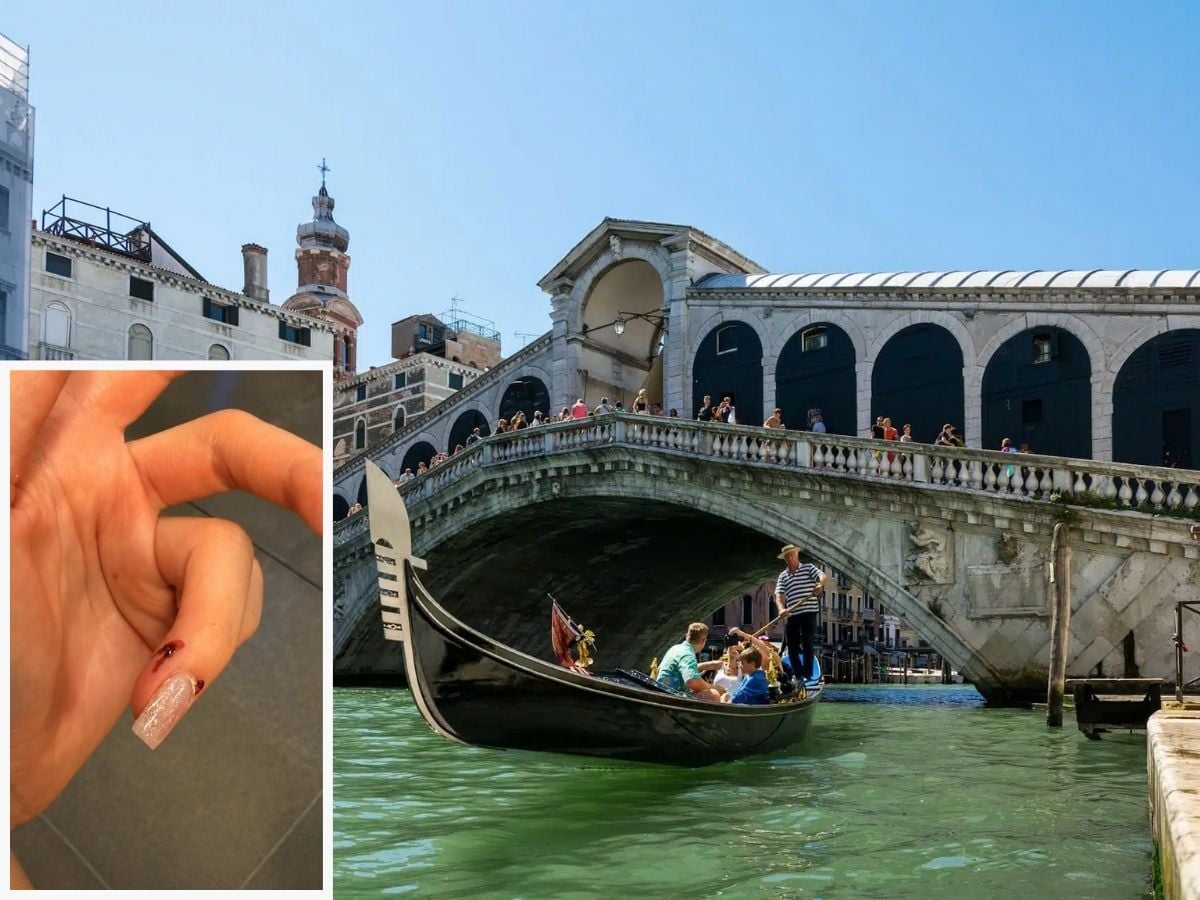 Venedik’te Rus turiste fare şoku: Gondol gezisi sonrası hastanelik oldu